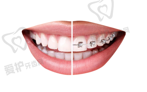 中山贝壳口腔门诊是否有等级划分