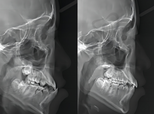 特色项目对比,各有什么拿手好戏?