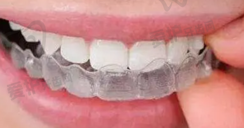 2、池州国康口腔周幸生医生种植牙怎么样?