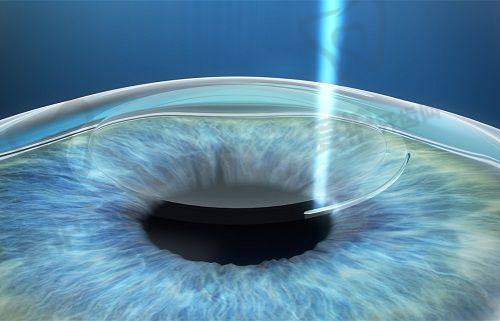 上饶爱尔眼科医院的服务质量怎么样?