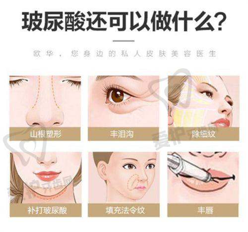 深圳阳光罗志敏医生预约挂号指南