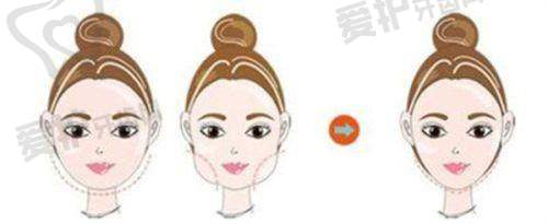 深圳阳光罗志敏医生整形技术怎么样?