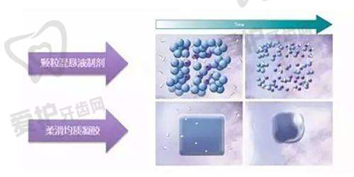 注射玻尿酸轮廓提升的注意事项