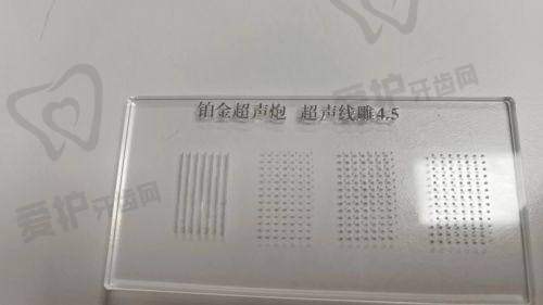 上海九院激光美容祛痘实例