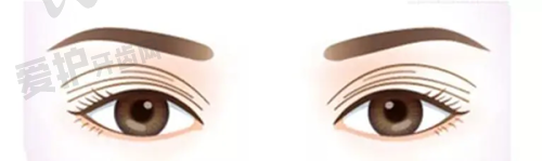 天津美莱整形医院的技术实力如何?