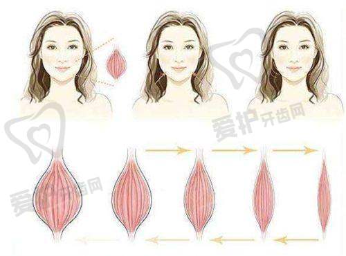 科学抗衰变得更美,水光针该如何正确使用?