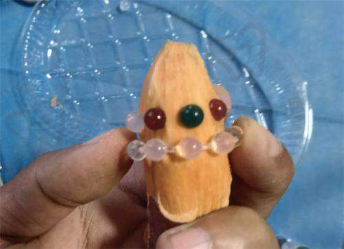 广州荔医余东文胸部异物取出技术有何优势?