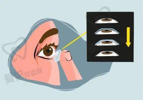 乌鲁木齐普瑞眼科医院怎么样