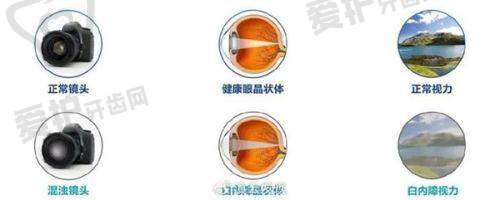 局部营养障碍会造成白内障吗?