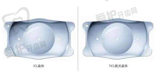 如何选择适合自己的ICL晶体植入手术医院和医生