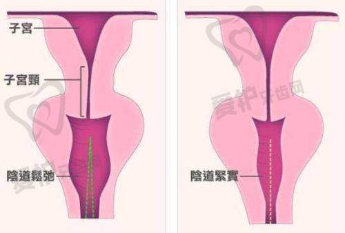 手术的安心性如何保护?