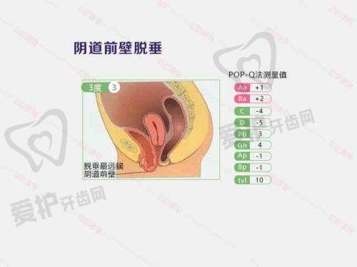 重庆军美刘艳医生的口碑如何?
