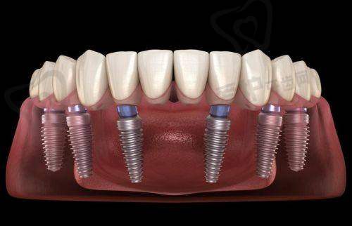 深圳同步齿科:科学化连锁经营的典范