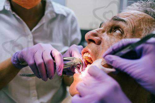 拔牙后清洁与消炎该怎么做?