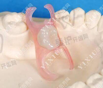 济南百年中牙口腔医院在全口假牙领域的未来发展方向是怎样的?