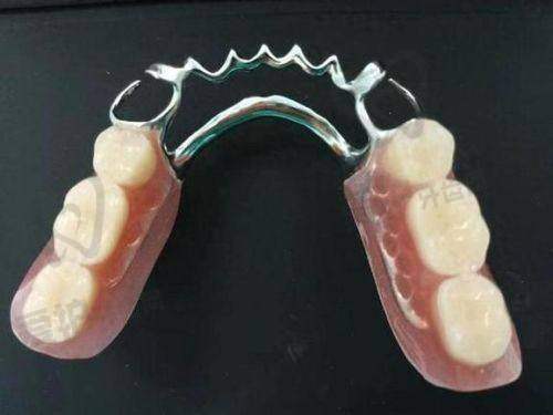 济南百年中牙口腔医院全口假牙9888元起，品质优助您畅享美味人生 